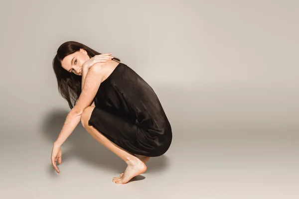 Barfuß-Model mit Vitiligo posiert im Kleid auf grauem Hintergrund mit Schatten — Stockfoto