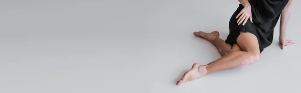 Vue recadrée de femme pieds nus avec vitiligo en robe satinée assise sur fond gris, bannière — Photo de stock