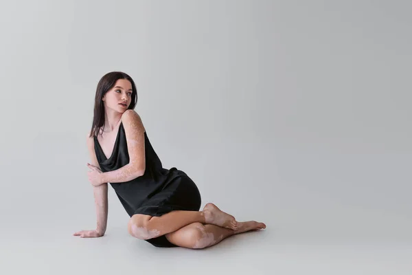Sinnliche Frau mit Vitiligo posiert im Kleid, während sie auf grauem Hintergrund sitzt — Stockfoto