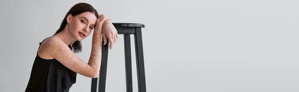 Young brunette woman with vitiligo looking at camera near chair isolated on grey, banner — Stock Photo