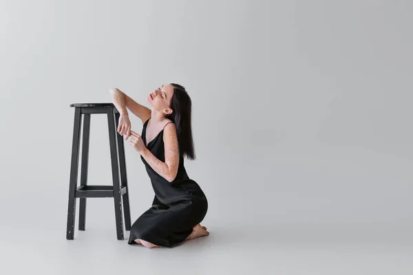 Sensual woman with vitiligo posing near chair on grey background — Stock Photo
