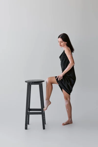 Jolie modèle pieds nus avec vitiligo debout près de la chaise sur fond gris — Photo de stock