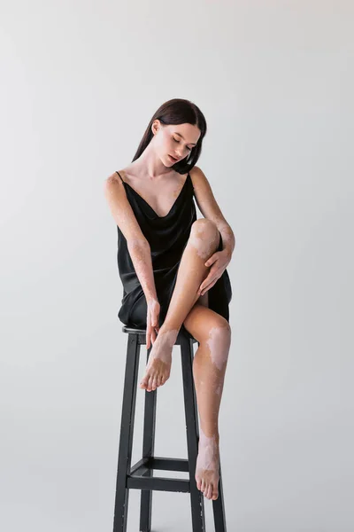 Mujer bonita con vitiligo tocando los pies desnudos mientras se sienta en la silla sobre fondo gris - foto de stock