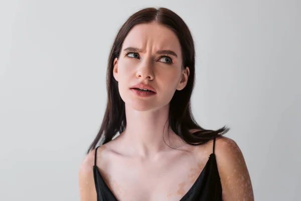 Mujer pensativa con vitiligo mirando hacia otro lado aislado en gris - foto de stock