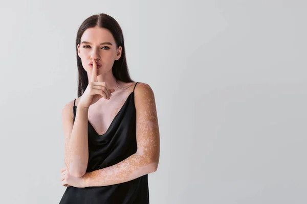 Stylish young woman with vitiligo showing secret gesture isolated on grey — Stock Photo