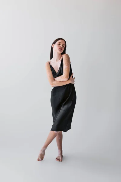 Volle Länge der barfüßigen Frau mit Vitiligo im Seidenkleid posiert auf grauem Hintergrund — Stockfoto