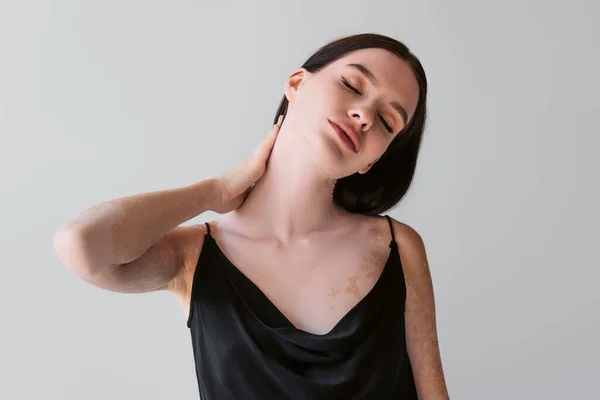 Giovane donna con vitiligine toccante collo e chiusura occhi isolati su grigio — Foto stock