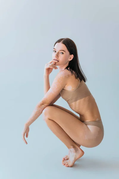 Brunette model with vitiligo sitting in beige bra top and panties on grey — Stock Photo