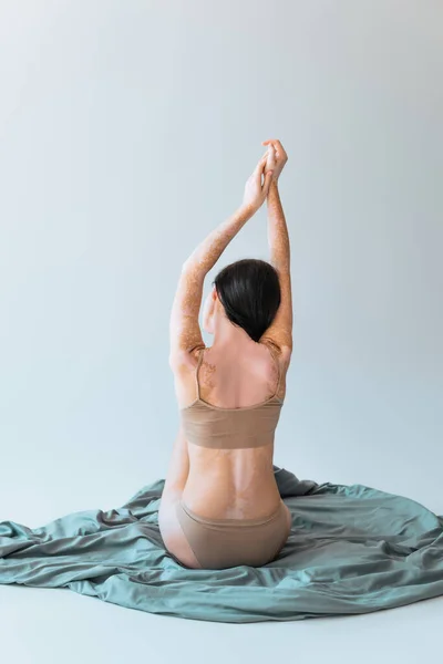 Vista posteriore di donna bruna con vitiligine condizione della pelle cronica seduta con le mani sollevate su coperta su sfondo grigio — Foto stock