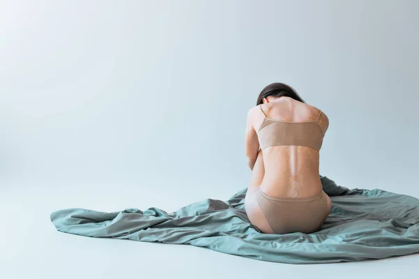 Vista posterior de la mujer morena con condición de piel crónica vitiligo sentado en manta sobre fondo gris - foto de stock