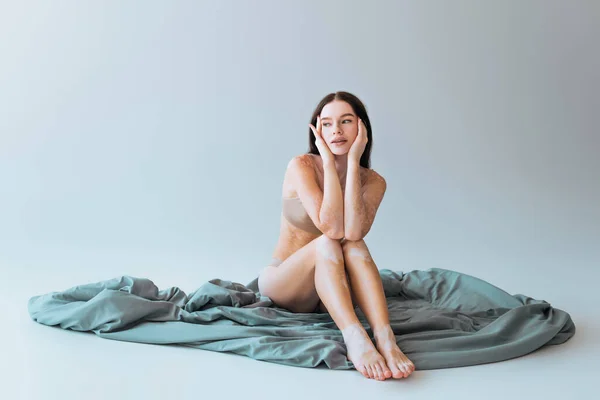 Sognante giovane donna con vitiligine condizione della pelle cronica seduta su coperta su sfondo grigio — Foto stock