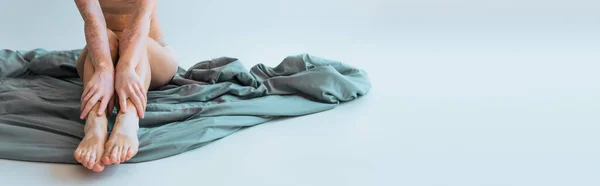 Частичный вид молодой женщины с хроническим заболеванием кожи витилиго сидя на одеяле на сером, баннер — стоковое фото