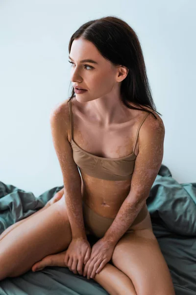 Morena mujer con condición de piel crónica vitiligo sentado en la manta mientras mira hacia otro lado en gris - foto de stock