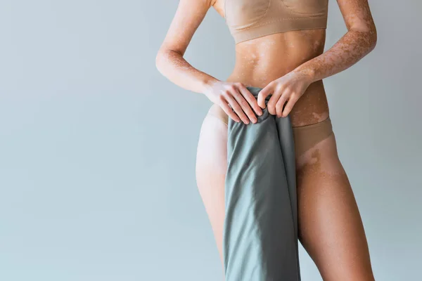 Abgeschnittene Ansicht der Frau mit Vitiligo Hautzustand halten Decke auf grauem Hintergrund — Stockfoto