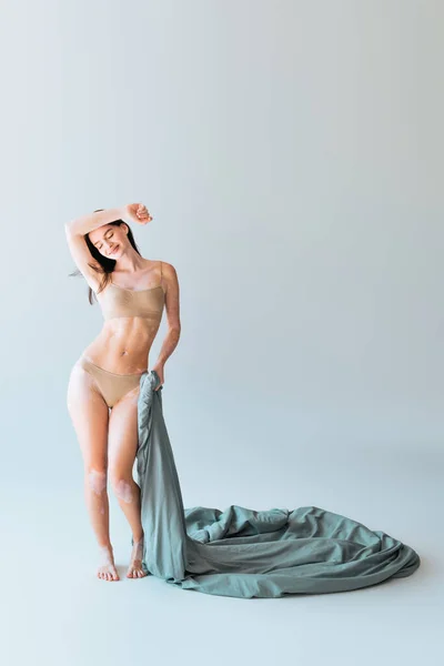 Volle Länge der fröhlichen Frau mit Vitiligo Hautzustand halten Decke auf grau — Stockfoto