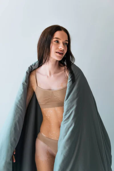 Mujer joven con enfermedad de la piel vitiligo de pie cubierta de manta aislada en gris - foto de stock