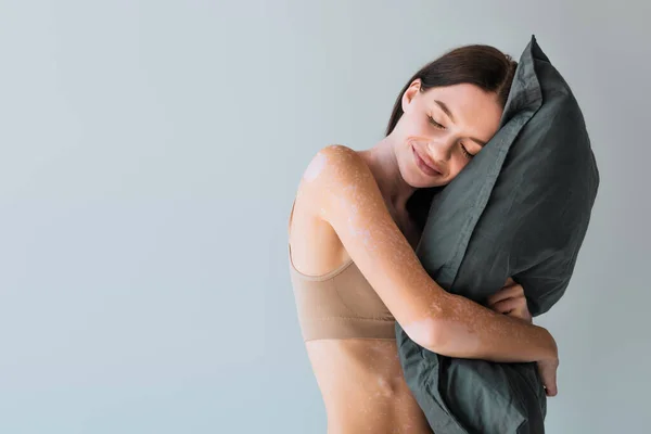 Happy young woman with vitiligo standing in beige lingerie and hugging pillow isolated on grey isolated on grey — Stock Photo