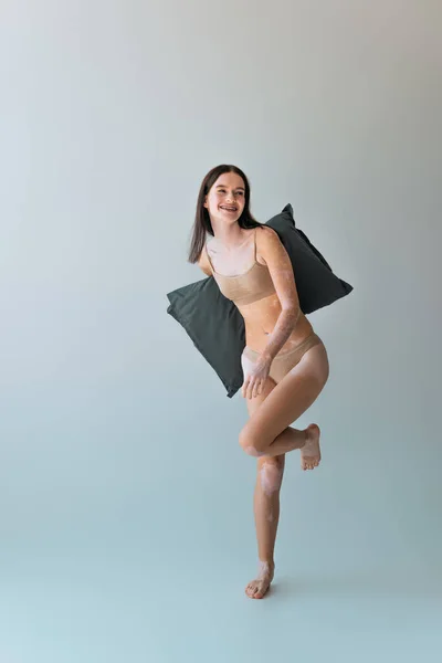 Повна довжина щасливої молодої жінки зі станом шкіри вітіліго, що тримає подушку на сірому — стокове фото