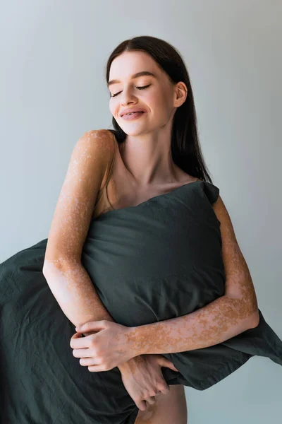 Довольная молодая женщина с витилиго держа подушку, улыбаясь изолированы на серый — стоковое фото