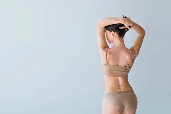 Vista trasera de mujer joven con vitiligo de pie en lencería beige y ajustando el pelo moreno aislado en gris - foto de stock