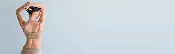 Vista posteriore di giovane donna con vitiligine in piedi in lingerie beige e regolazione capelli castani isolati su grigio, banner — Foto stock