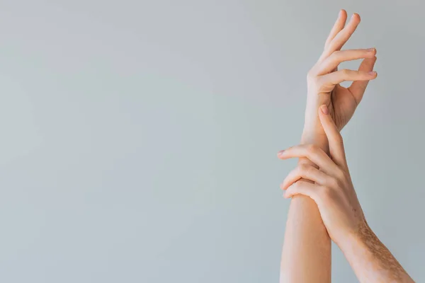 Cropped view of elegant female hands with vitiligo isolated on grey — Stock Photo