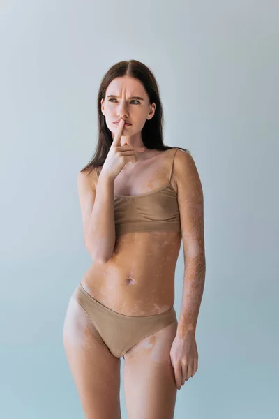 Nachdenkliche junge Frau mit Vitiligo-Denken und anrührenden Lippen mit dem Finger isoliert auf grau — Stockfoto