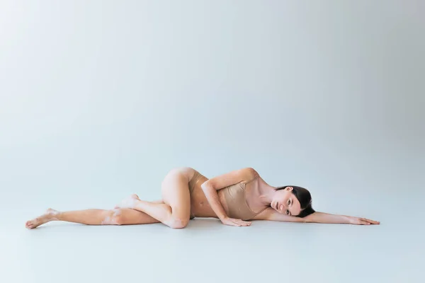 Full length of barefoot and young woman with vitiligo lying in beige lingerie on grey background — Stock Photo
