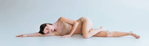 Full length of barefoot and young woman with vitiligo lying in beige lingerie on grey background, banner — Stock Photo
