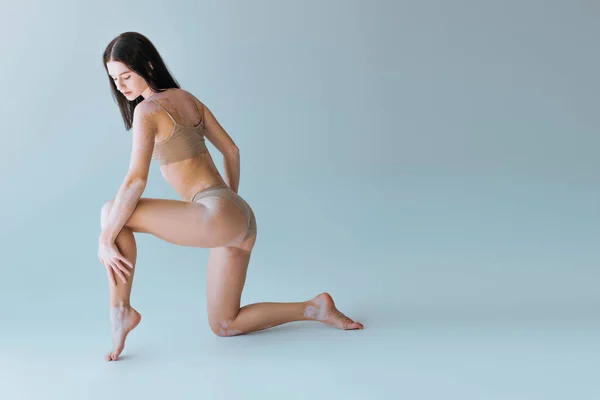Pleine longueur de femme pieds nus avec vitiligo posant en lingerie beige sur fond gris — Photo de stock