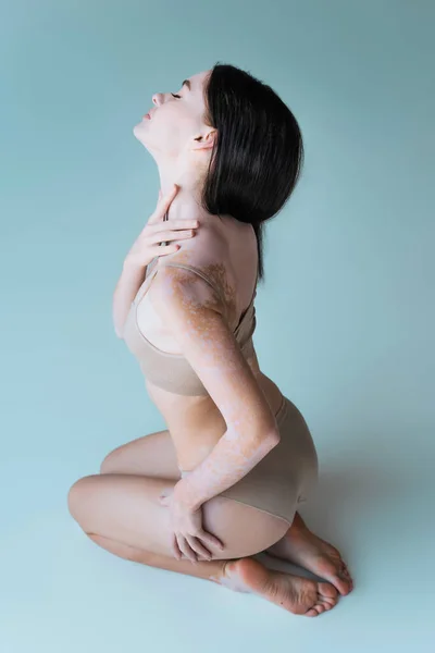 Pieds nus et jeune femme avec vitiligo et les yeux fermés posant en lingerie beige sur gris — Photo de stock