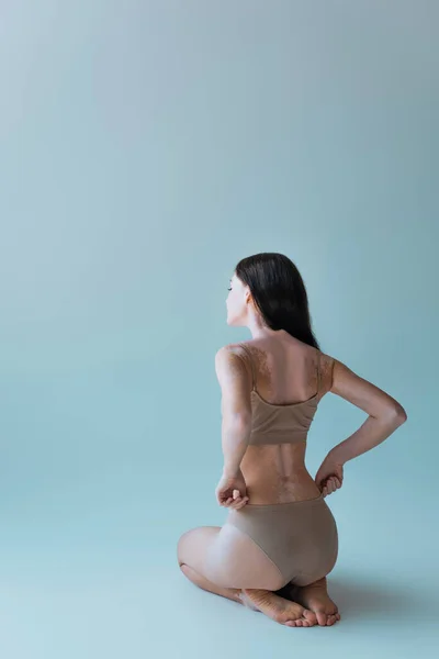 Pleine longueur de pieds nus et jeune femme avec vitiligo assis et ajustement culotte beige sur gris — Photo de stock