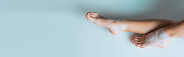 Cropped view of woman with vitiligo and bare feet on grey background, banner — Stock Photo