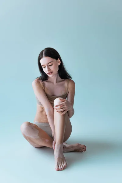 Full length of barefoot young woman with vitiligo sitting in beige lingerie on grey — Stock Photo