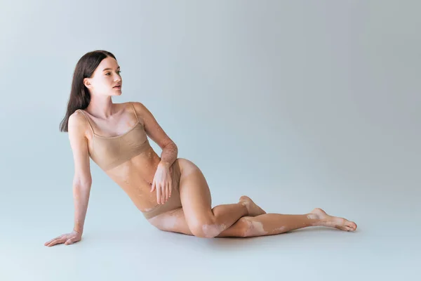 Pleine longueur de brune jeune femme avec vitiligo assis en lingerie beige sur gris — Photo de stock