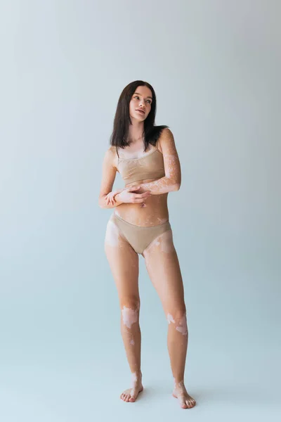 Longitud completa de la joven morena con vitiligo posando en lencería beige mientras mira hacia otro lado en gris - foto de stock