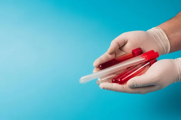 Cropped view of doctor in latex gloves holding throat swabs and blood samples on blue background — Photo de stock