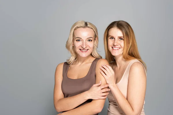 Unbekümmerte Frauen mit Hautproblemen blicken vor grauem Hintergrund in die Kamera — Stockfoto