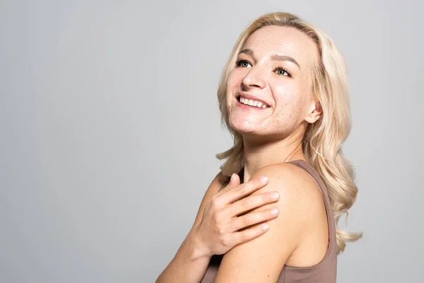 Positive blonde Frau mit Akne-Berührung Schulter isoliert auf grau — Stockfoto