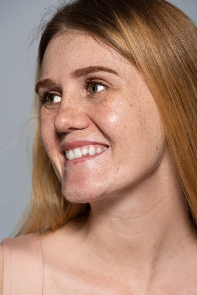 Fröhliche junge Frau mit Hautproblem schaut vereinzelt auf grau — Stockfoto