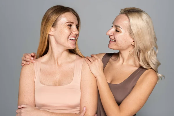 Positive Frau mit Problemhaut umarmt Freundin isoliert auf grau — Stockfoto
