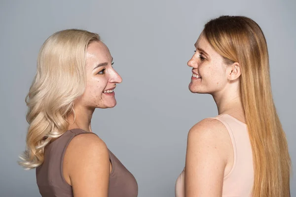 Side view of smiling friends with skin issue looking at each other isolated on grey — Stock Photo