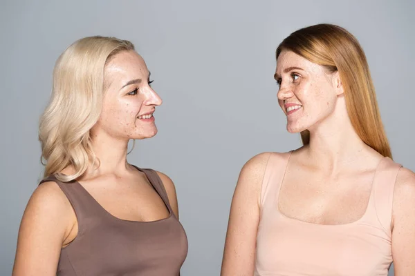 Blonde Frau mit Akne im Gesicht sieht sommersprossigen Freund isoliert auf grau — Stockfoto