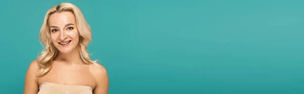 Positive blonde woman with problem skin standing isolated on turquoise, banner — Stock Photo