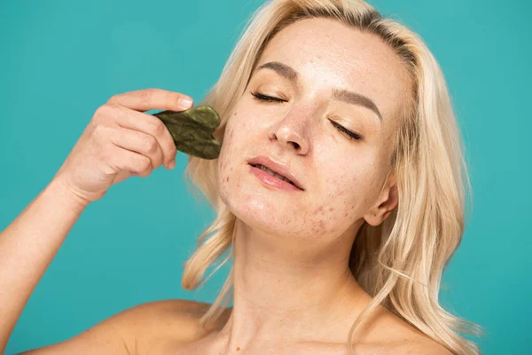 Femme blonde avec acné massant visage avec grattoir visage jade isolé sur turquoise — Photo de stock