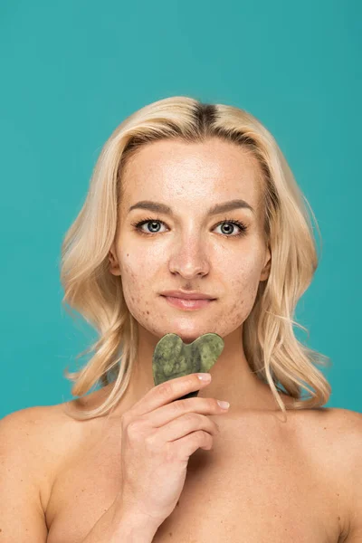 Blondine mit Akne hält Jade-Gesichtsschaber in der Hand und blickt isoliert in die Kamera auf Türkis — Stockfoto