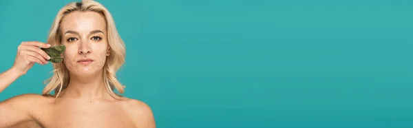 Young woman with acne massaging face with jade face scraper isolated on turquoise, banner — Stock Photo