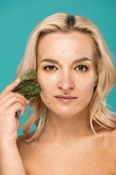 Mulher loira com manchas massageando rosto com raspador de rosto isolado em turquesa — Fotografia de Stock