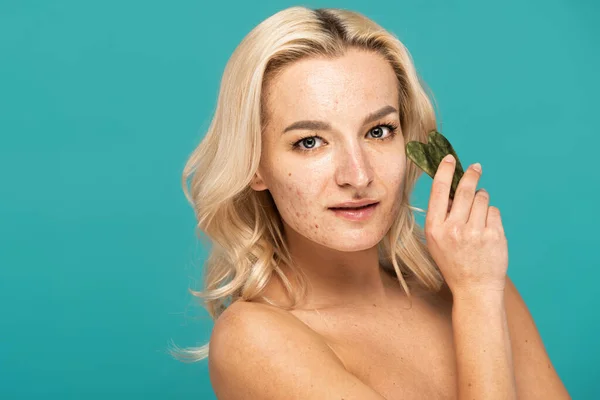 Mulher loira com problemas de pele segurando raspador rosto jade isolado em turquesa — Fotografia de Stock