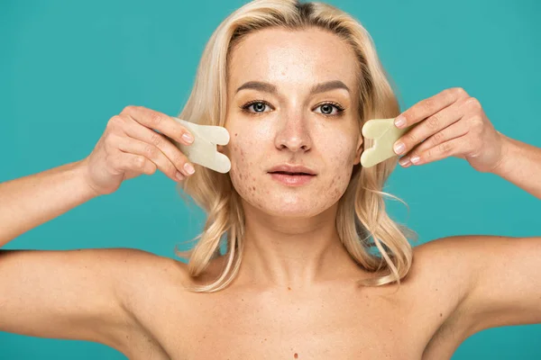 Blonde Frau mit Makeln mit Gesichtsschaber isoliert auf Türkis — Stockfoto